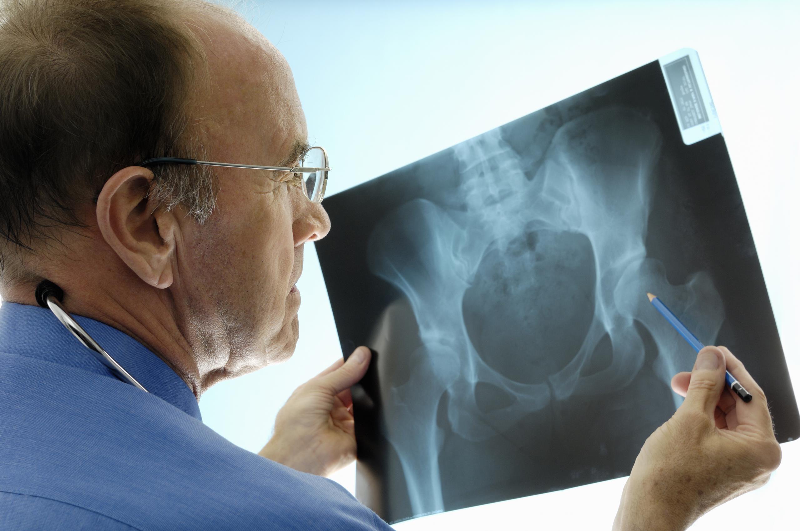 Healthcare professional looking at a scan